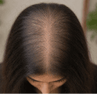 Diffuse Thinning