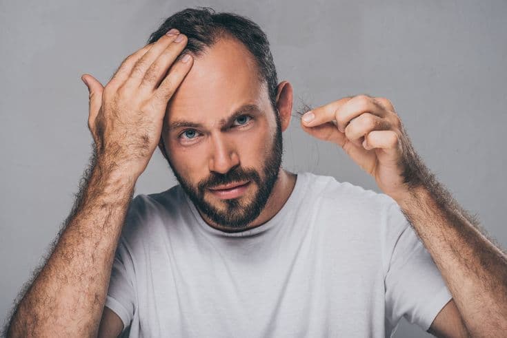 What’s Behind the Surge in Hair Loss in 2026?
